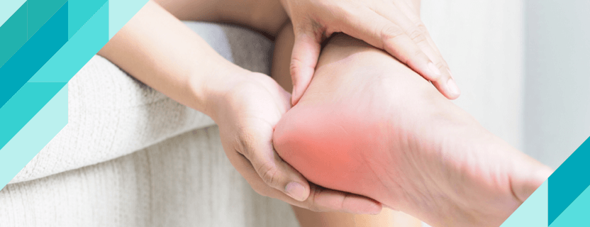 Heel Spurs and Symptoms