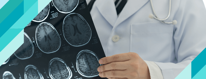 What are Gliomas (Glial Tumors)?