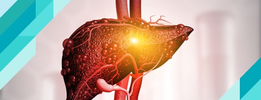 What is Liver Failure? What are the Symptoms?