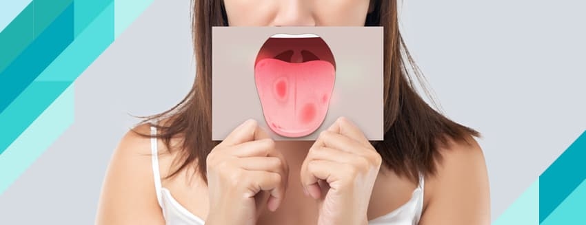 What is Oral Cancer?