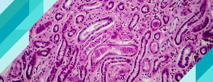 What is Vasculitis?
