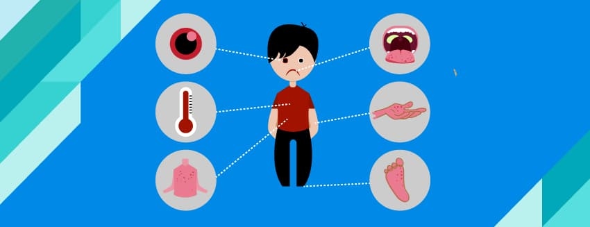 What is Kawasaki Disease?