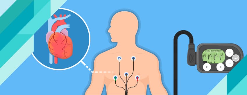 What is Heart Arrhythmia?