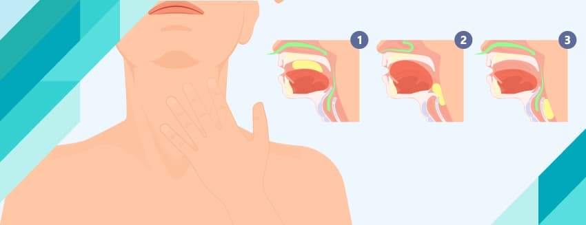 What is Dysphagia (Difficulty Swallowing)? How is it treated?