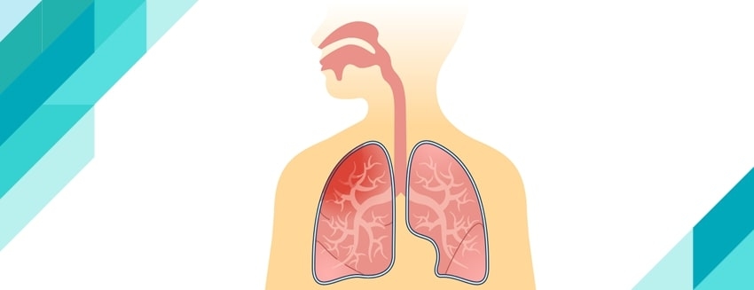 What is Pleurisy? What are the Symptoms?