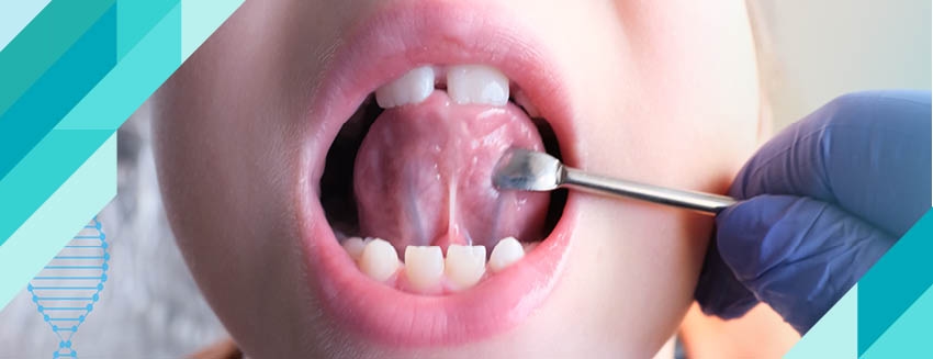 What is Tongue Tie? How to recognize it?