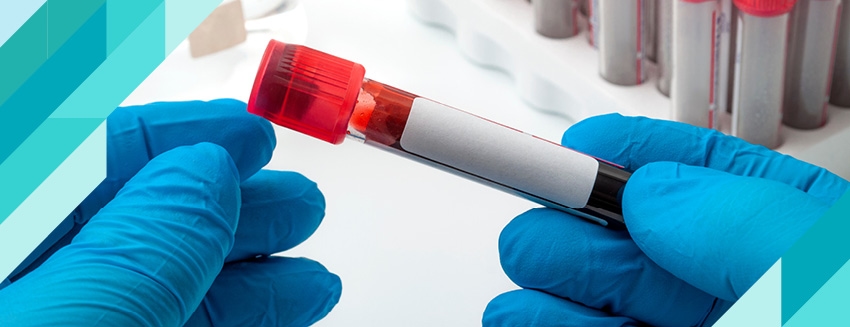 What is a Hemogram Test (Complete Blood Count)?