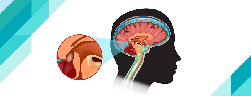 What is the pineal gland?