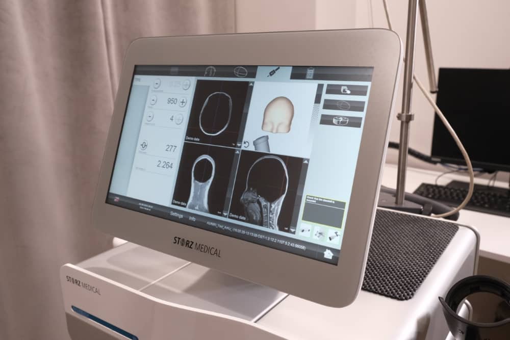 ما هو تخطيط كهربية العضل (EMG)؟ كيف يتم أخذ تخطيط كهربية العضل؟