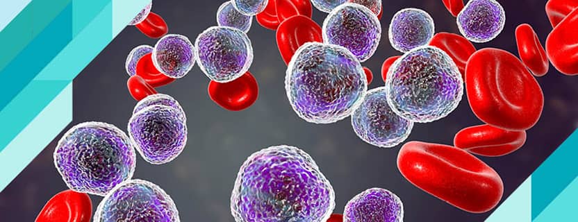 Lenfoma (Lenf Kanseri) Nedir? Lenfoma Neden Olur?