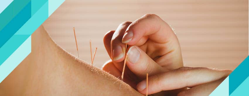 Akupunktur Nedir? Hangi Hastalıklarda Uygulanır?