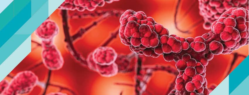 Multipl Miyelom Nedir?