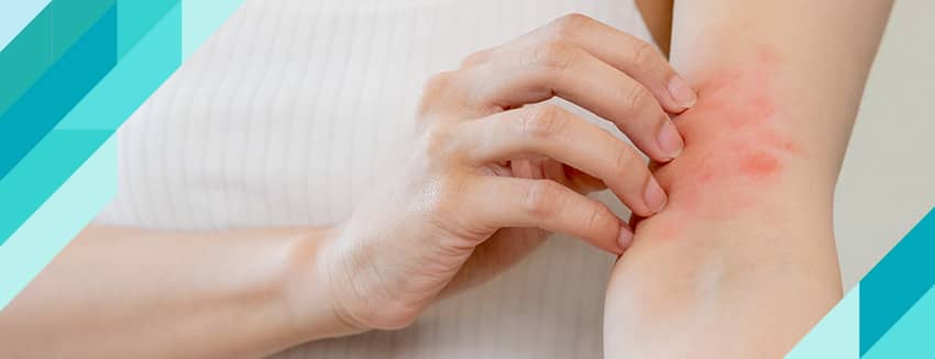 Atopik Dermatit Nedir?