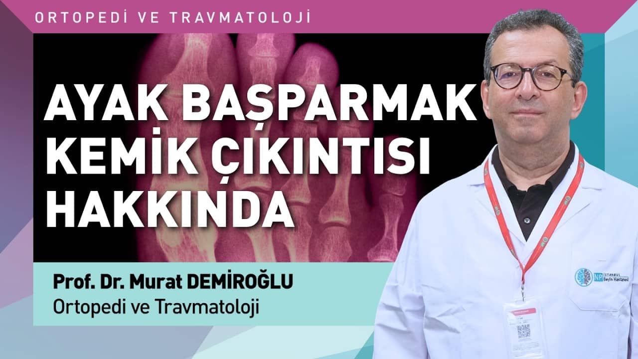 Hallux Valgus Gece Atelleri İşe Yarar mı?