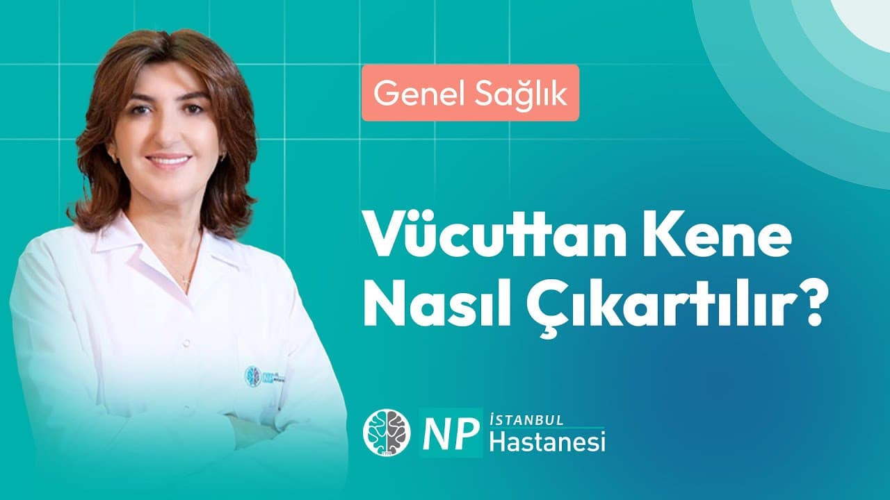 Vücuttan Kene Nasıl Çıkartılır?-thumbnail