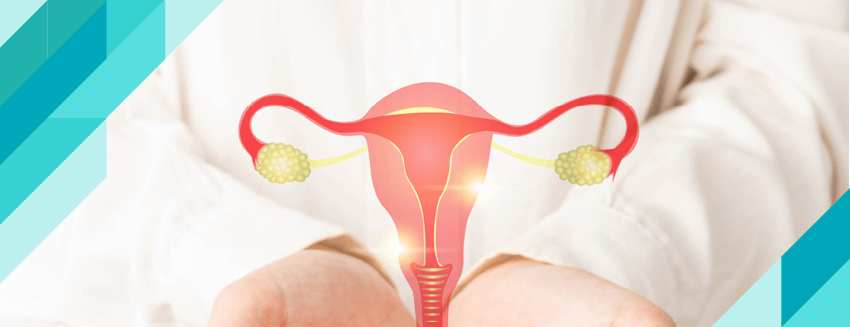 What is Polycystic Ovary Syndrome?  