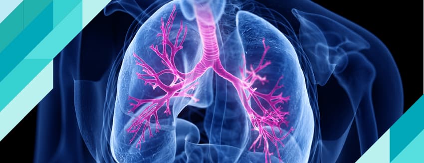 Kistik Fibrozis Nedir?