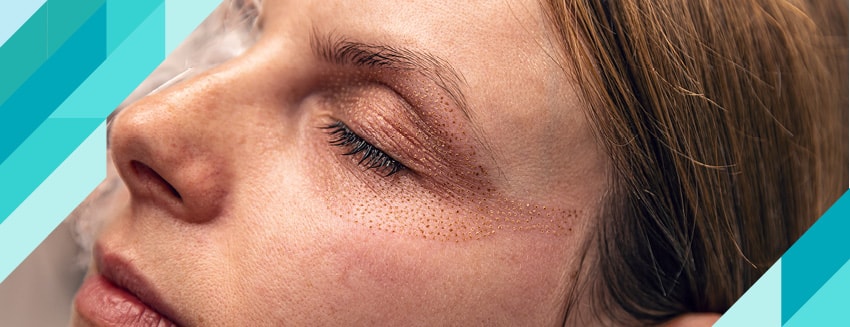 Fibroblast Nedir?