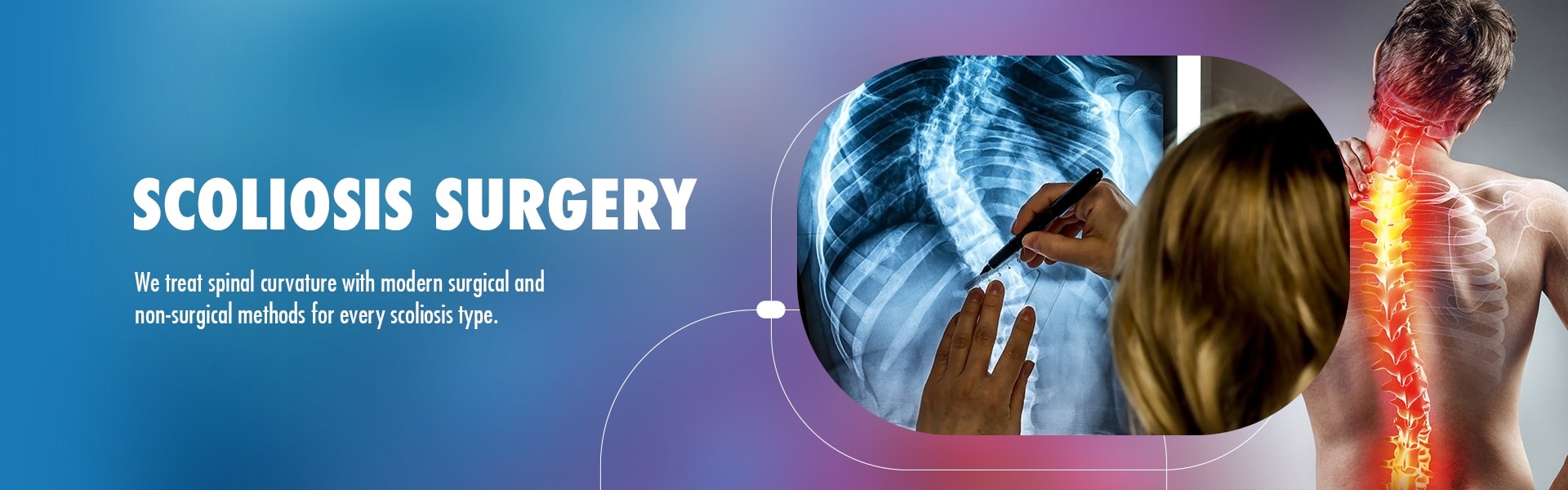 Scoliosis Surgery