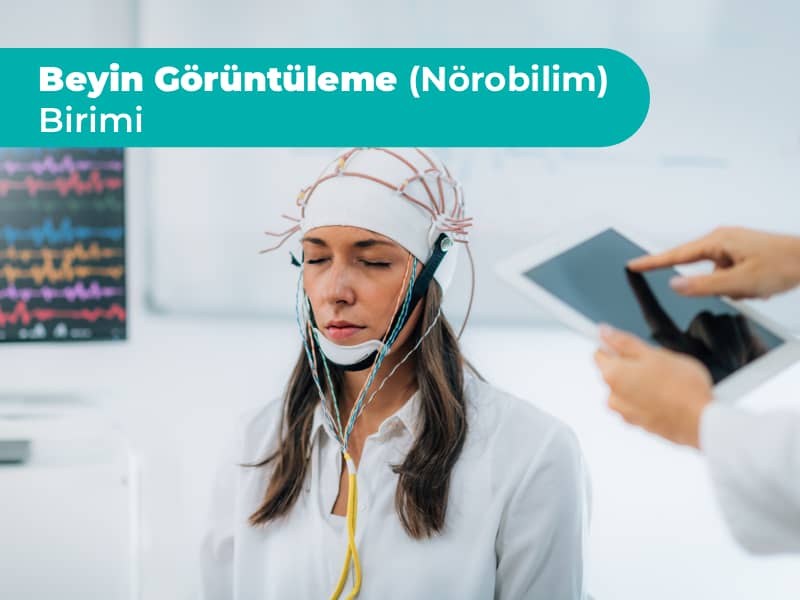 Unité d'imagerie cérébrale (neurosciences)