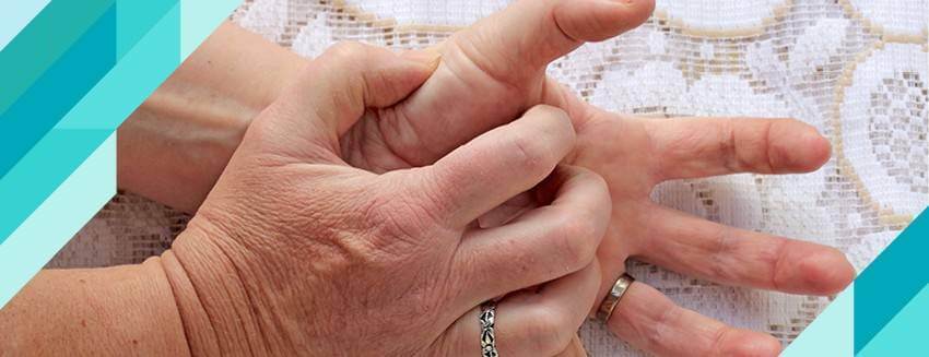 Alcoholic neuropathy affects hands and feet