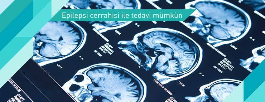 Epilepsi cerrahisi ile tedavi mümkün
