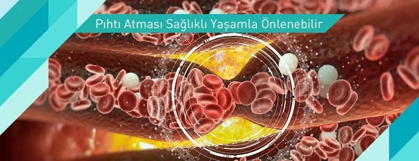 Pıhtı atması sağlıklı yaşamla önlenebilir.