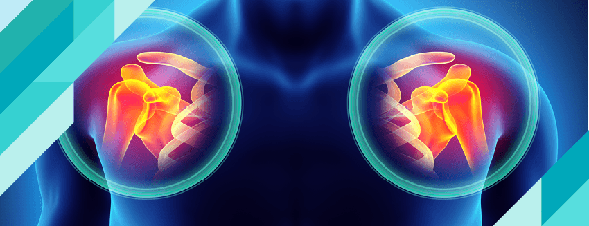 Shoulder Arthritis (Calcification)