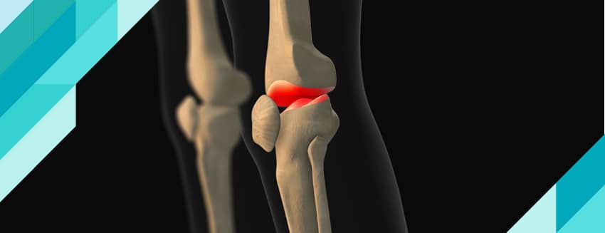 What is Fluid Loss in the Knee?